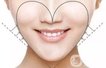 面部吸脂*果圖 面部吸脂注意事項(xiàng)