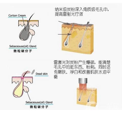 做黑臉娃娃費(fèi)用多少 黑臉娃娃的作用是什么