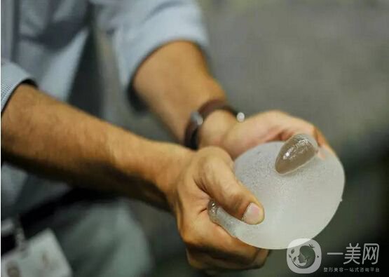 假體隆胸影響哺乳嗎 假體隆胸有什么后遺癥