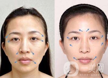 第四代熱瑪吉*果,第四代熱瑪優(yōu)勢(shì)