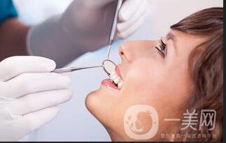 光固化樹脂補牙價格