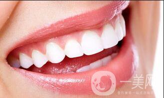 光固化樹脂補牙價格