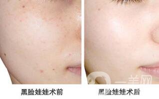 黑臉娃娃多少錢(qián)