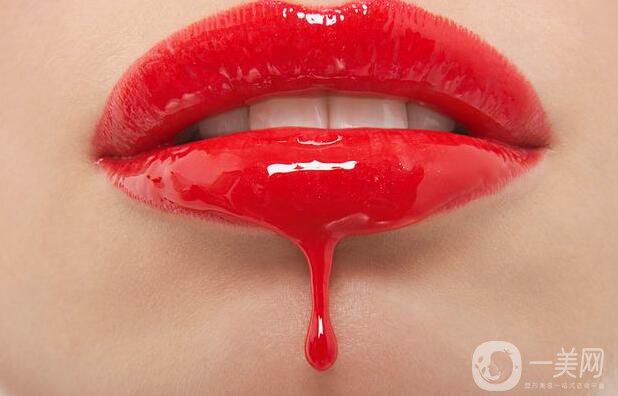 玻尿酸豐唇珠后需注意什么 該如何護理？