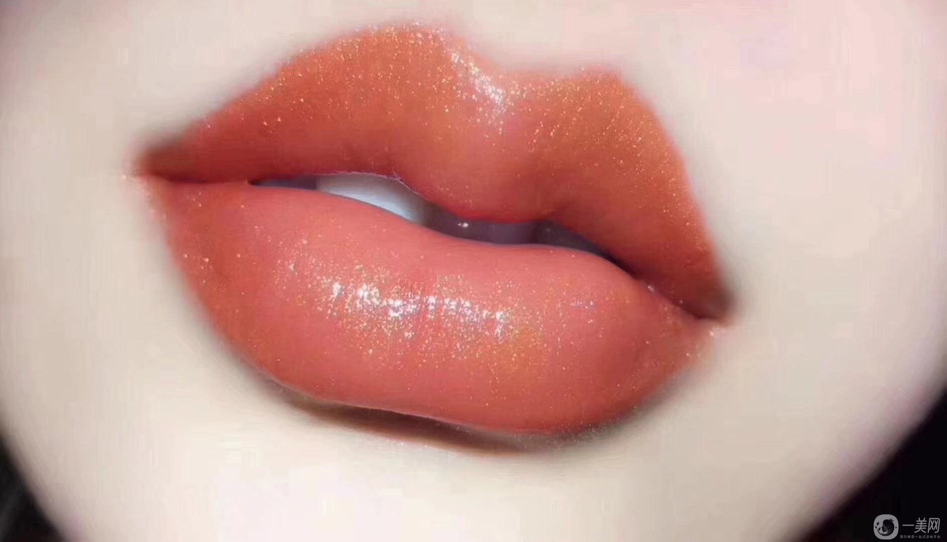 玻尿酸豐唇要幾支 普通女孩子負(fù)擔(dān)得起嗎？