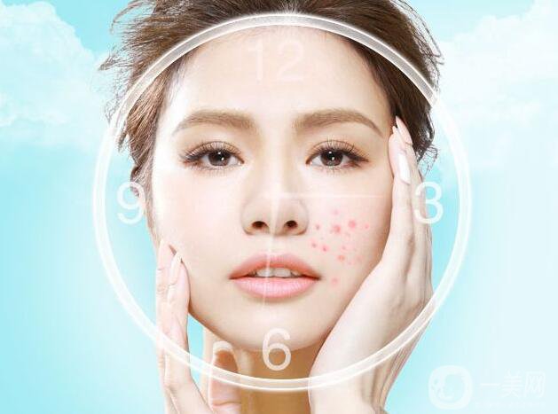 痤瘡調(diào)節(jié)的*佳方法是什么呢?