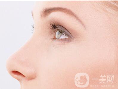 做個鼻翼縮一次多少錢