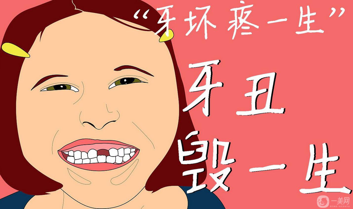 烤瓷牙價格,烤瓷牙種類