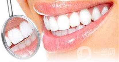 烤瓷牙價格,烤瓷牙種類