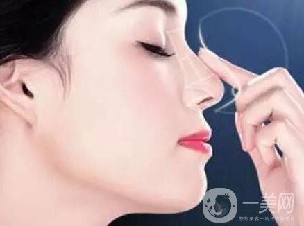 非手術隆鼻多少錢,非手術隆鼻*果自然嗎