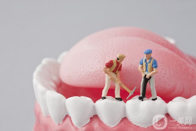 一個(gè)烤瓷牙多少錢(qián) 價(jià)格和哪些因素相關(guān)？