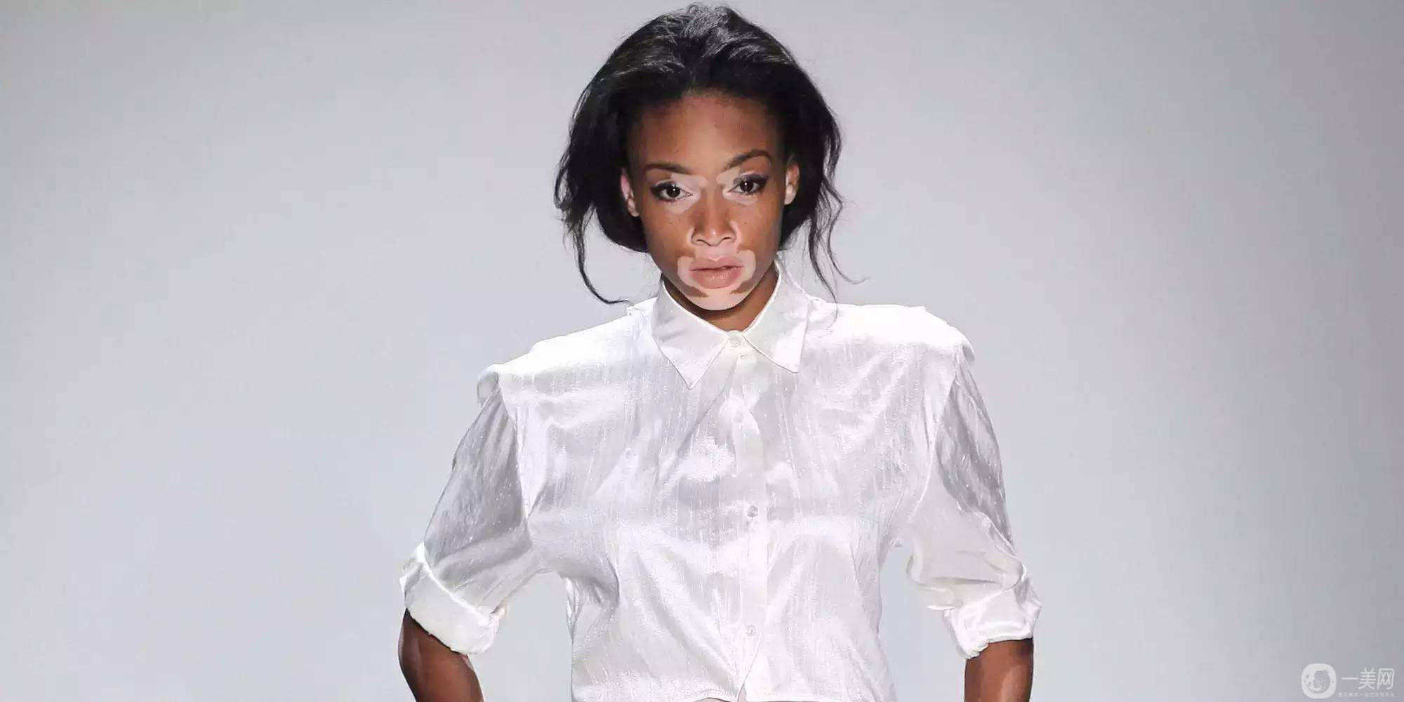 出現(xiàn)白斑該如何處理呢？