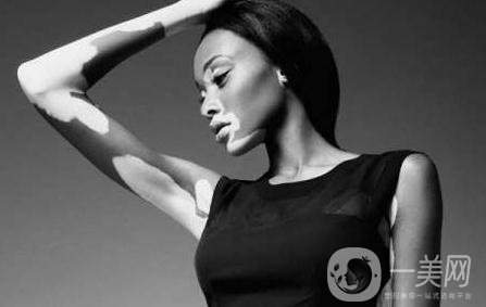 出現(xiàn)白斑該如何處理呢？