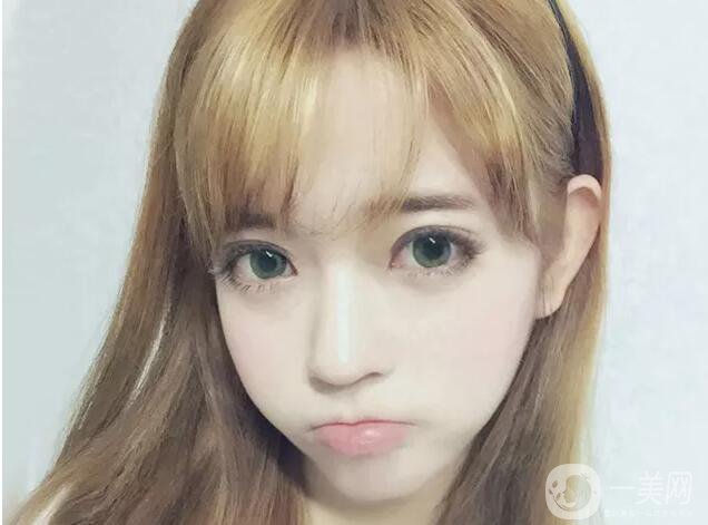 什么眼皮不能割雙眼皮手術(shù) 割雙眼皮注意事項