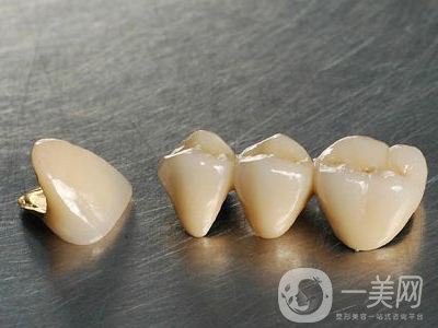 純鈦烤瓷牙價(jià)格 純鈦烤瓷牙的壽命*嗎