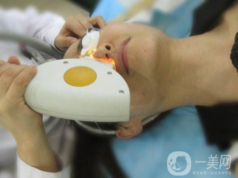 光子嫩膚去痘印*果 光子嫩膚祛痘印原理