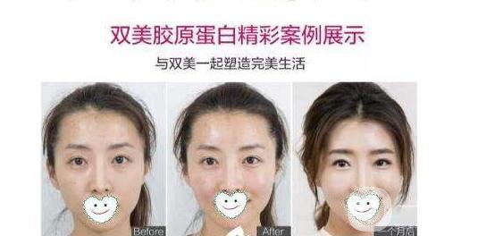 雙美膠原蛋白可溶解嗎 雙美膠原蛋白的作用