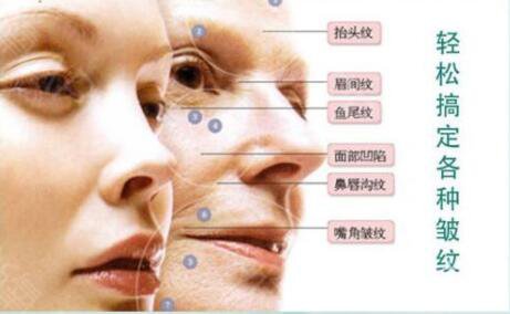 整容手術(shù)要多久時(shí)間 整容手術(shù)風(fēng)險(xiǎn)有多大