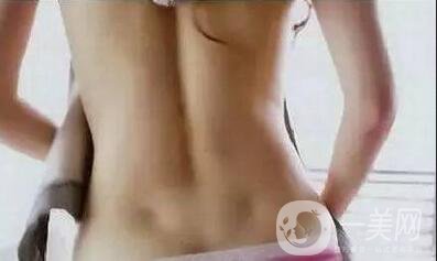 360吸脂減肥靠譜嗎,360吸脂減肥會(huì)不會(huì)反彈