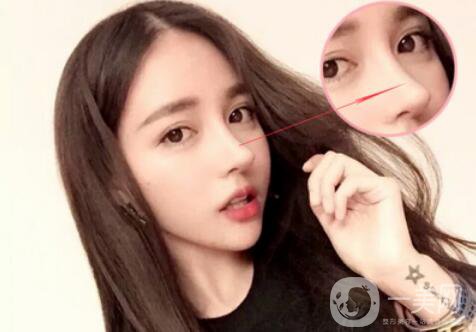 歪鼻矯正手術(shù)是怎樣的 手術(shù)方法有哪些？