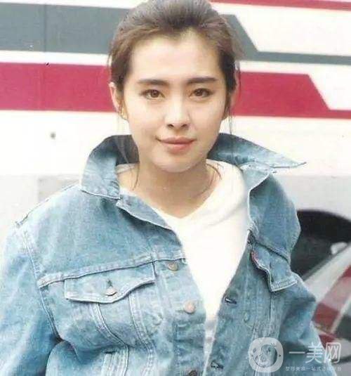 雙頜前突是什么 凸嘴不好看該怎么辦？