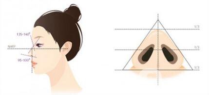 鷹鉤鼻矯正手術(shù)是怎么做的呢？