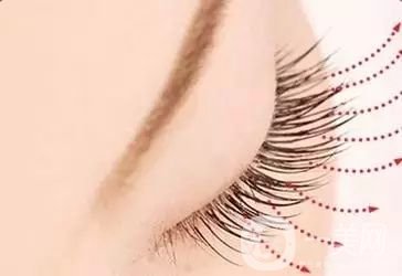 種睫毛多少錢 種睫毛手術(shù)時間是多久