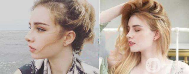 做下巴好不好 做下巴整形手術(shù)的方法