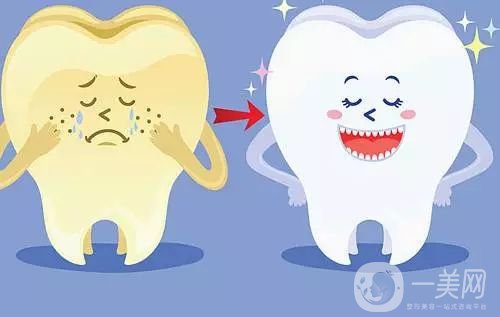 洗牙的價(jià)格是多少 洗牙后注意事項(xiàng)