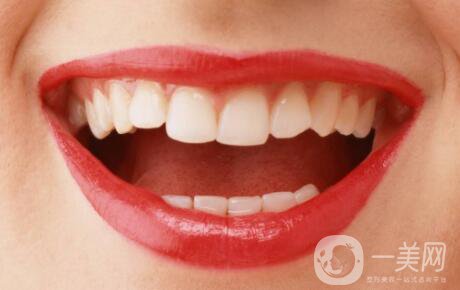 種牙的價(jià)格多少 影響種牙價(jià)格的原因是什么