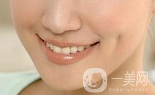 人造酒窩前后照片,人造酒窩多少錢