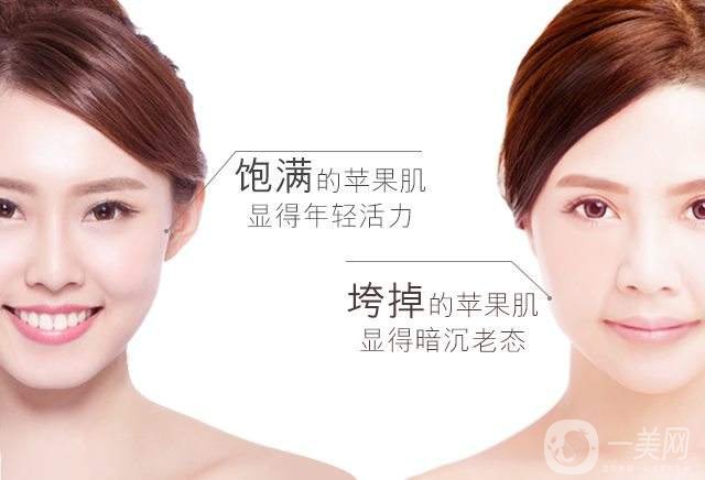 打了蘋果肌硬塊多久消 術(shù)后需要注意什么