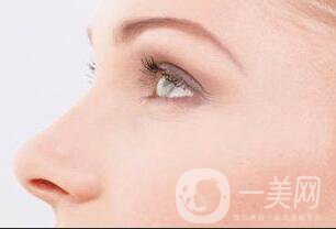 北京駝峰鼻矯正好嗎,北京駝峰鼻矯正*果