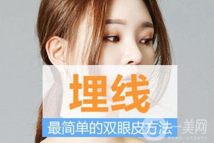 埋線雙眼皮*果圖