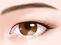 開眼角的*果怎么樣 好不好？