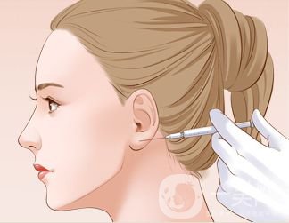 注射玻尿酸豐耳垂前后 豐耳垂*果好不好？