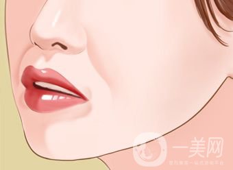 自體脂肪填充鼻唇溝怎么樣 能保持多久？