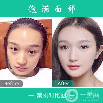 西安艾娜薇特醫(yī)療美容診所