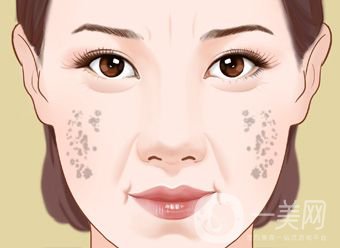 怎樣治老年斑 調(diào)節(jié)方法有哪些？