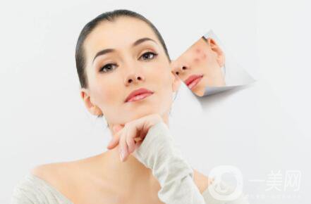 祛痘微針幾次多久見* 祛痘微針需要打幾次