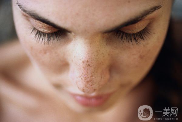 磁光祛斑多少錢一次？會(huì)反彈嗎？