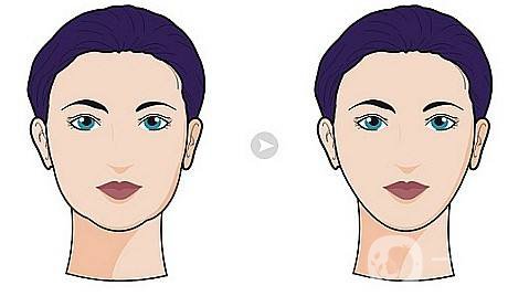 什么是* *手術(shù)的特點(diǎn)有哪些