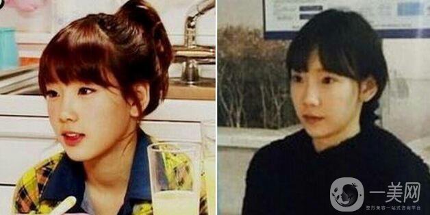 金泰妍整容了嗎?金泰妍整容變臉史詳細(xì)扒皮貼