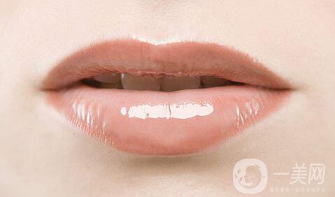玻尿酸豐唇怎么樣？