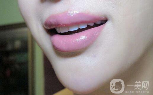 玻尿酸豐唇怎么樣？