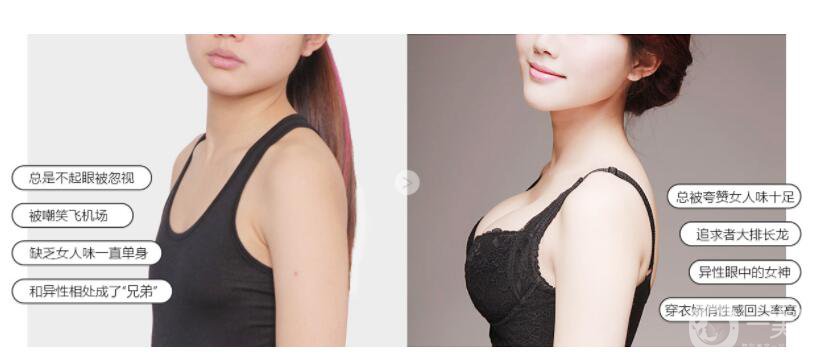 乳房整形手術(shù)價(jià)格 乳房整形手術(shù)貴不貴