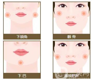 微型面部輪廓是什么 哪些人適合做面部輪廓