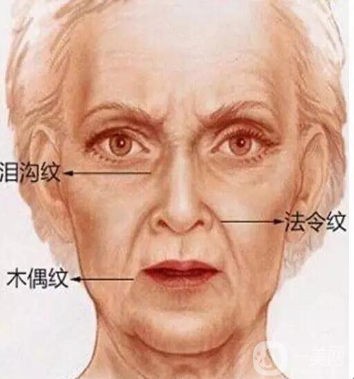 打去皺紋針的危害