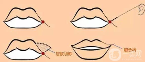 標(biāo)準(zhǔn)的仰月唇女明星有哪些？其中還有AB的整容模板！