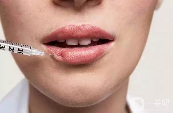 標(biāo)準(zhǔn)的仰月唇女明星有哪些？其中還有AB的整容模板！